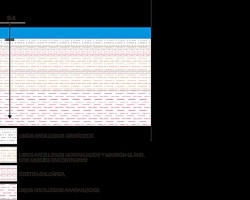 Obra civil Obra civil